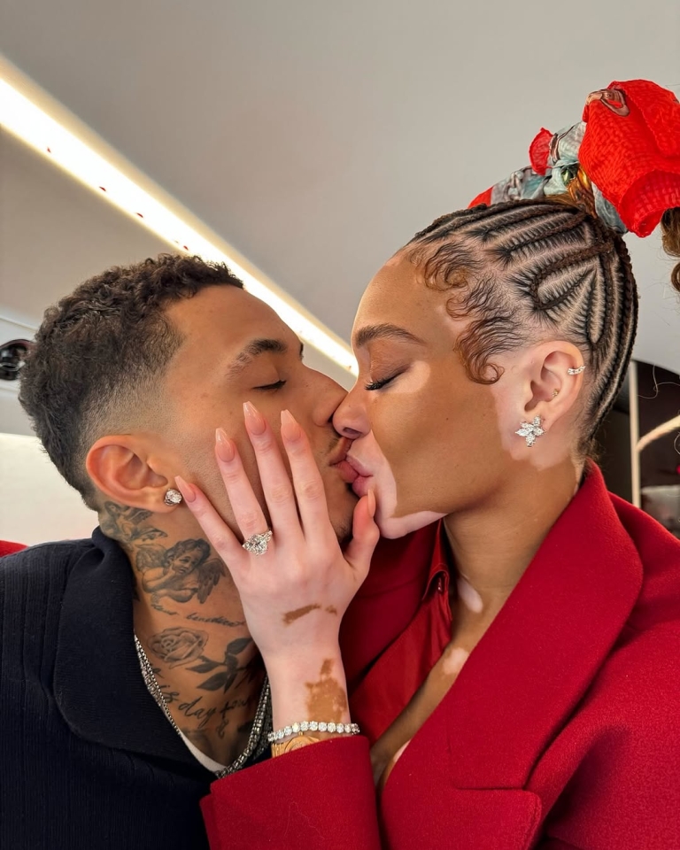 Valentine’s Day aftermath: Winnie Harlow i Kyle Kuzma su vereni